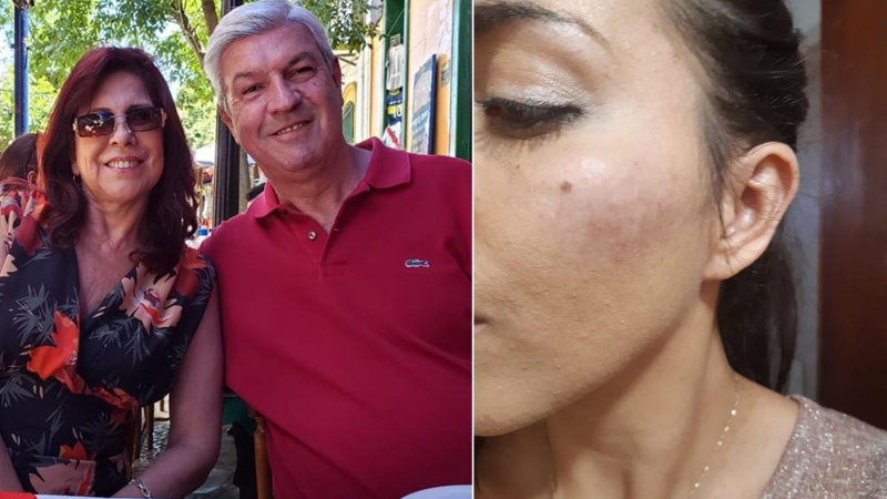 Imputan a funcionario por golpear en la cara a una abogada