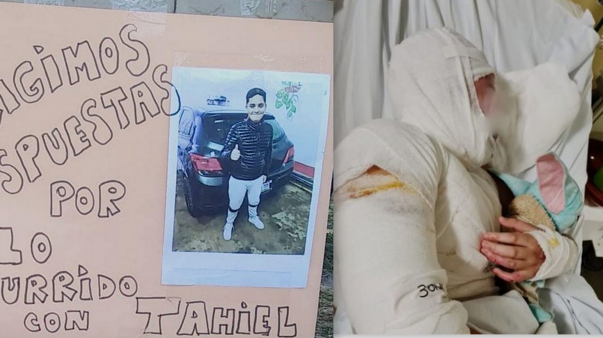 Madre de alumno quemado en Feria de Ciencias exige respuestas del Estado