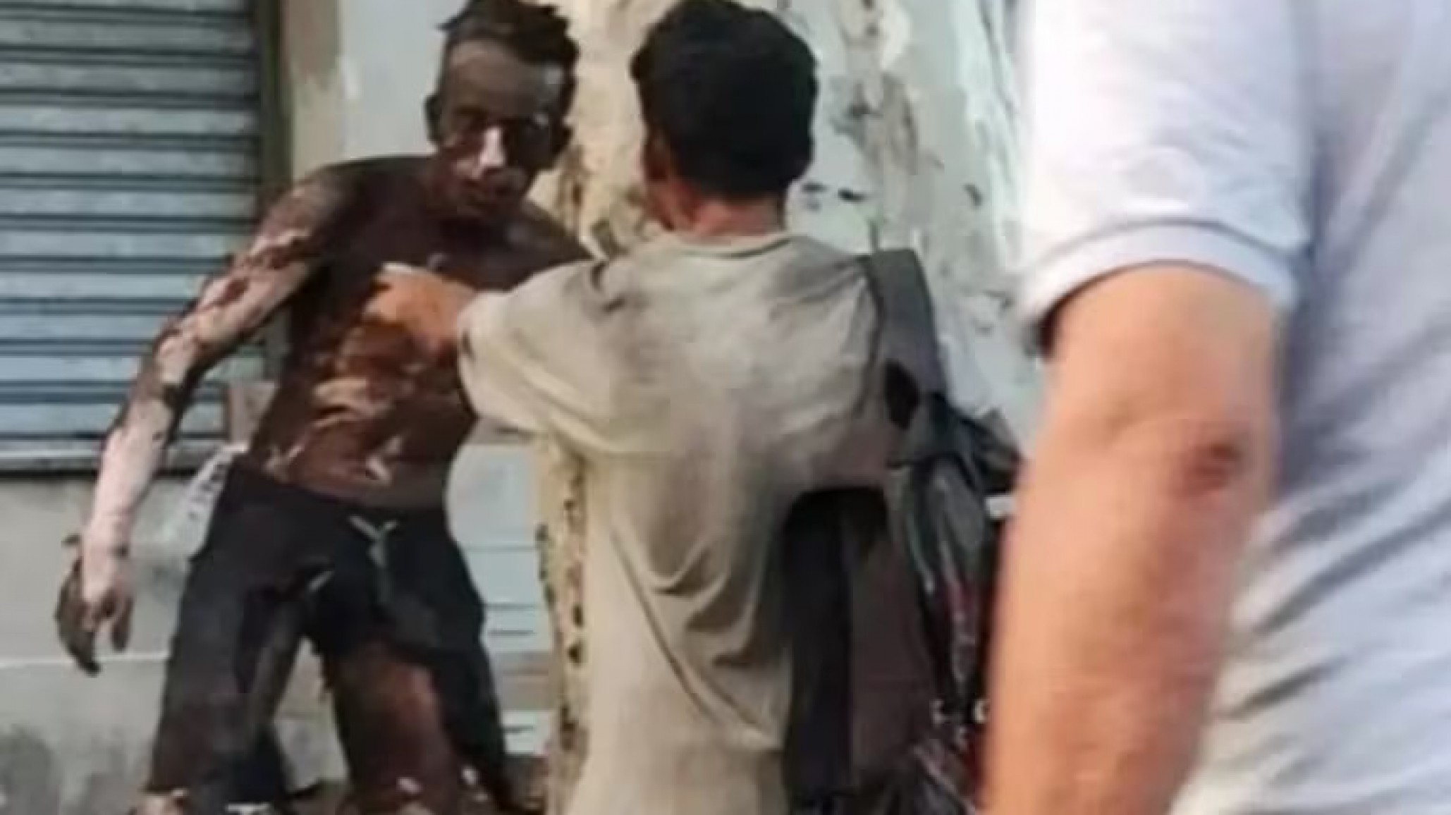 Falleció el hombre que sufrió quemaduras en el 90% de su cuerpo al electrocutarse: el caso