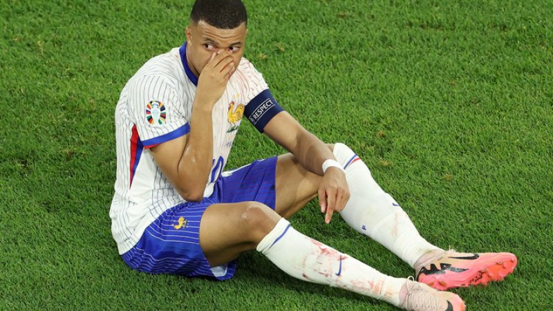 Mbappé sufrió una fractura de nariz: ¿Seguirá jugando en la Eurocopa?
