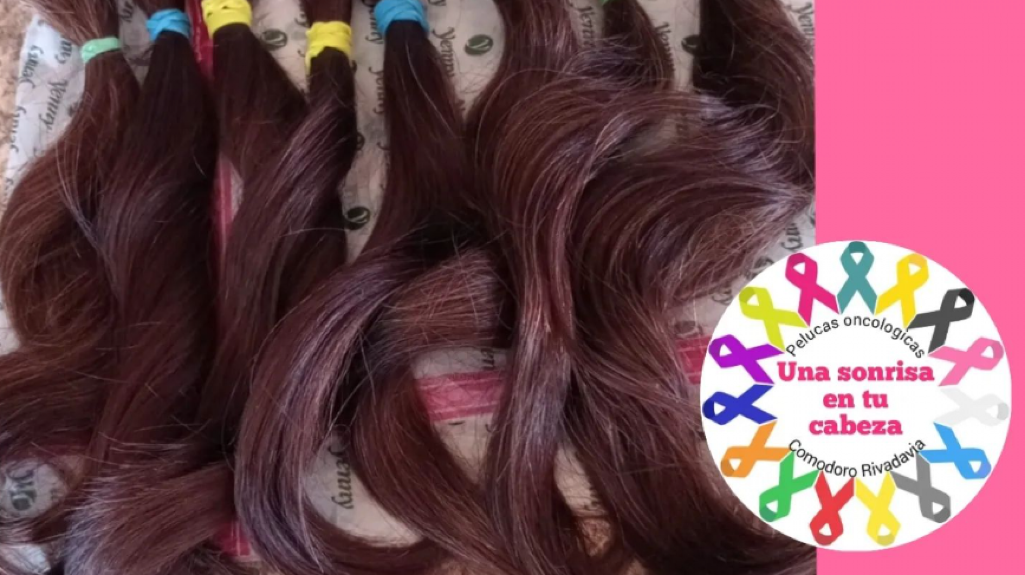 Una Sonrisa en tu Cabeza tendrá nuevo espacio en Barrio Roca: "Ya tenemos 20 pelucas pedidas"