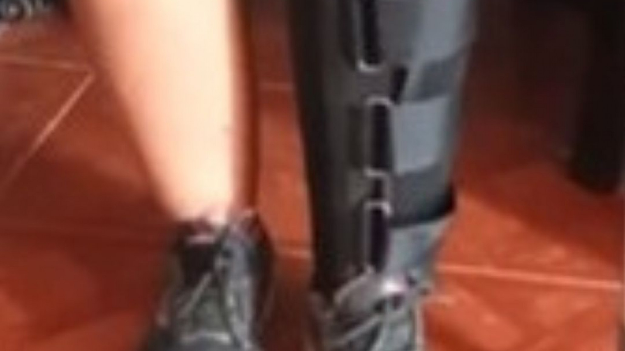 Verónica Hernández denuncia negligencia municipal tras accidente: "Me está costando muchísimo recuperar la movilidad"