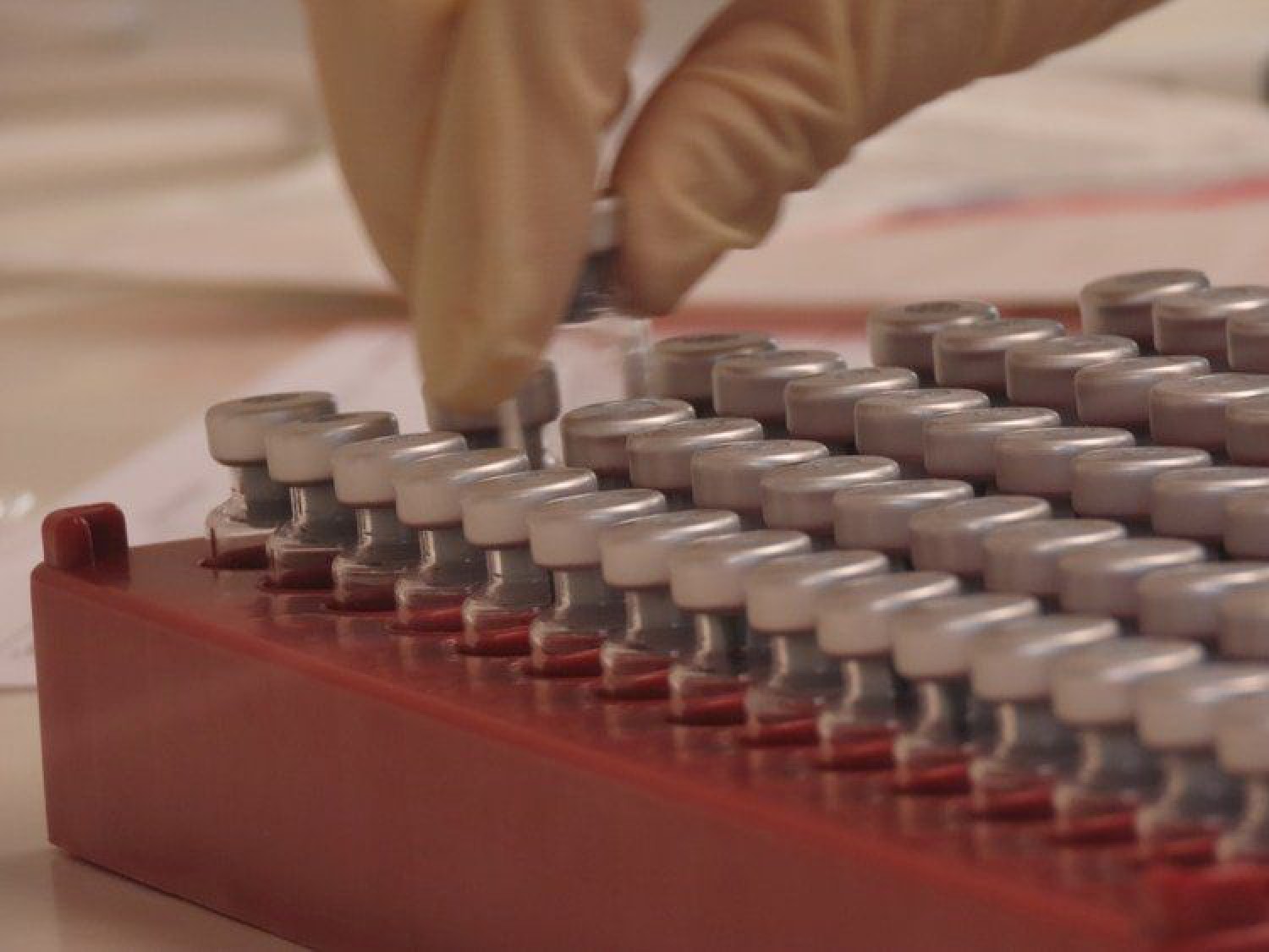 Vacuna inglesa contra coronavirus: funcionó en monos