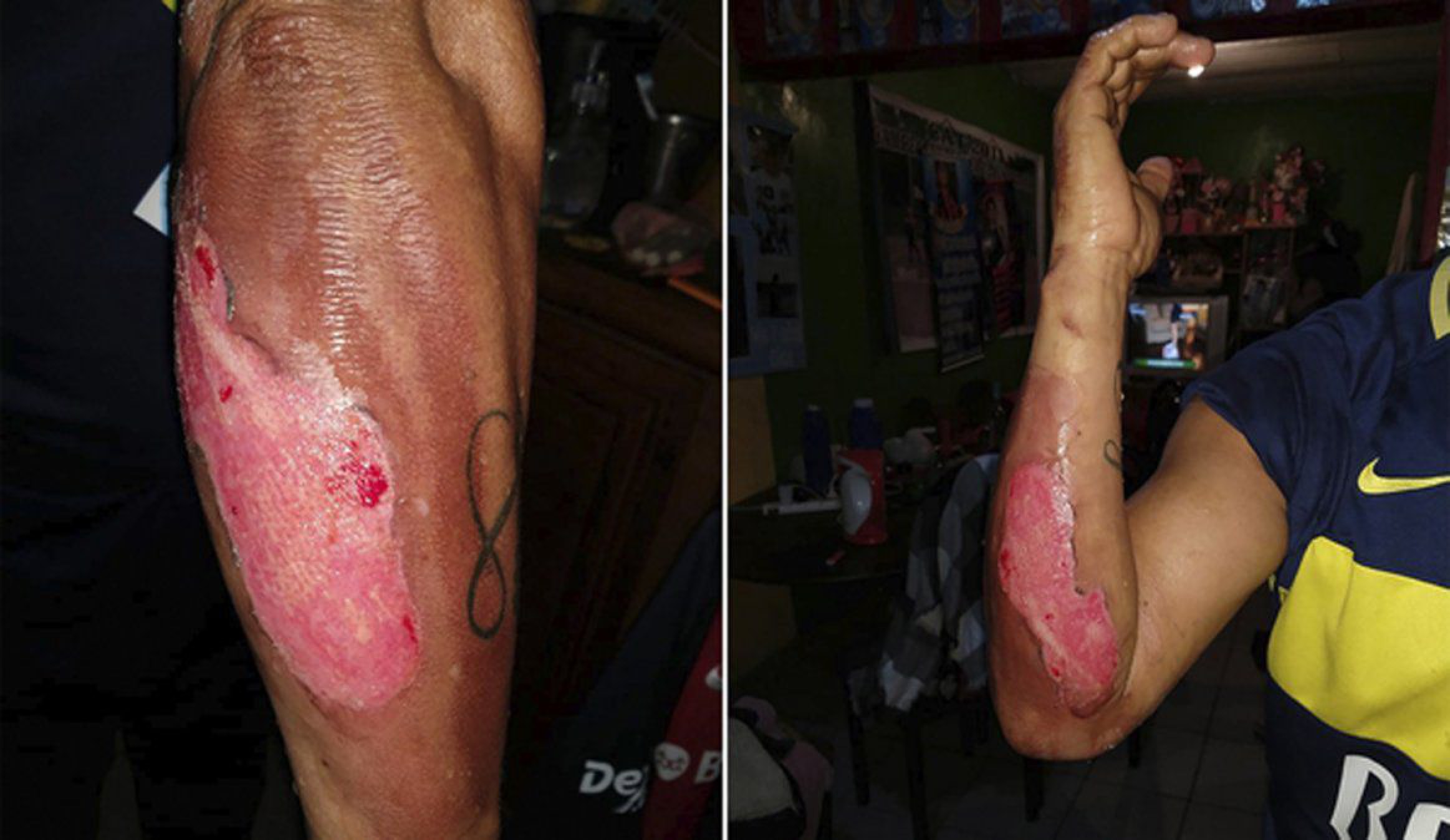 Prisión preventiva para un hombre que quemó viva a su ex mujer