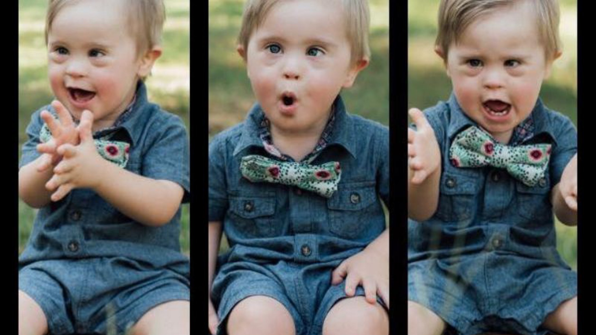 Síndrome de Down: lo rechazaron como modelo pero ahora es una estrella web