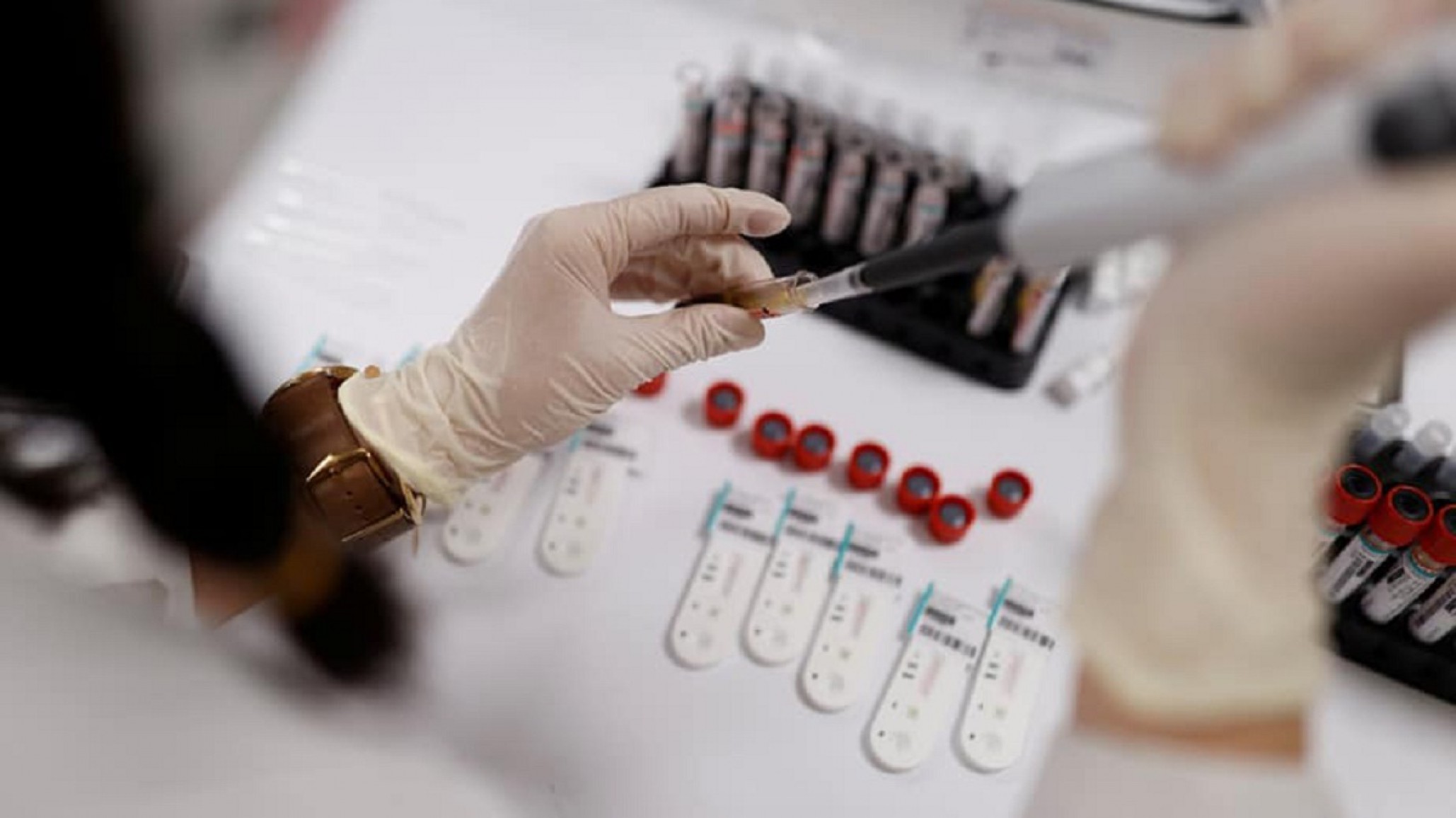 Coronavirus: la pérdida del olfato vinculada a su letalidad