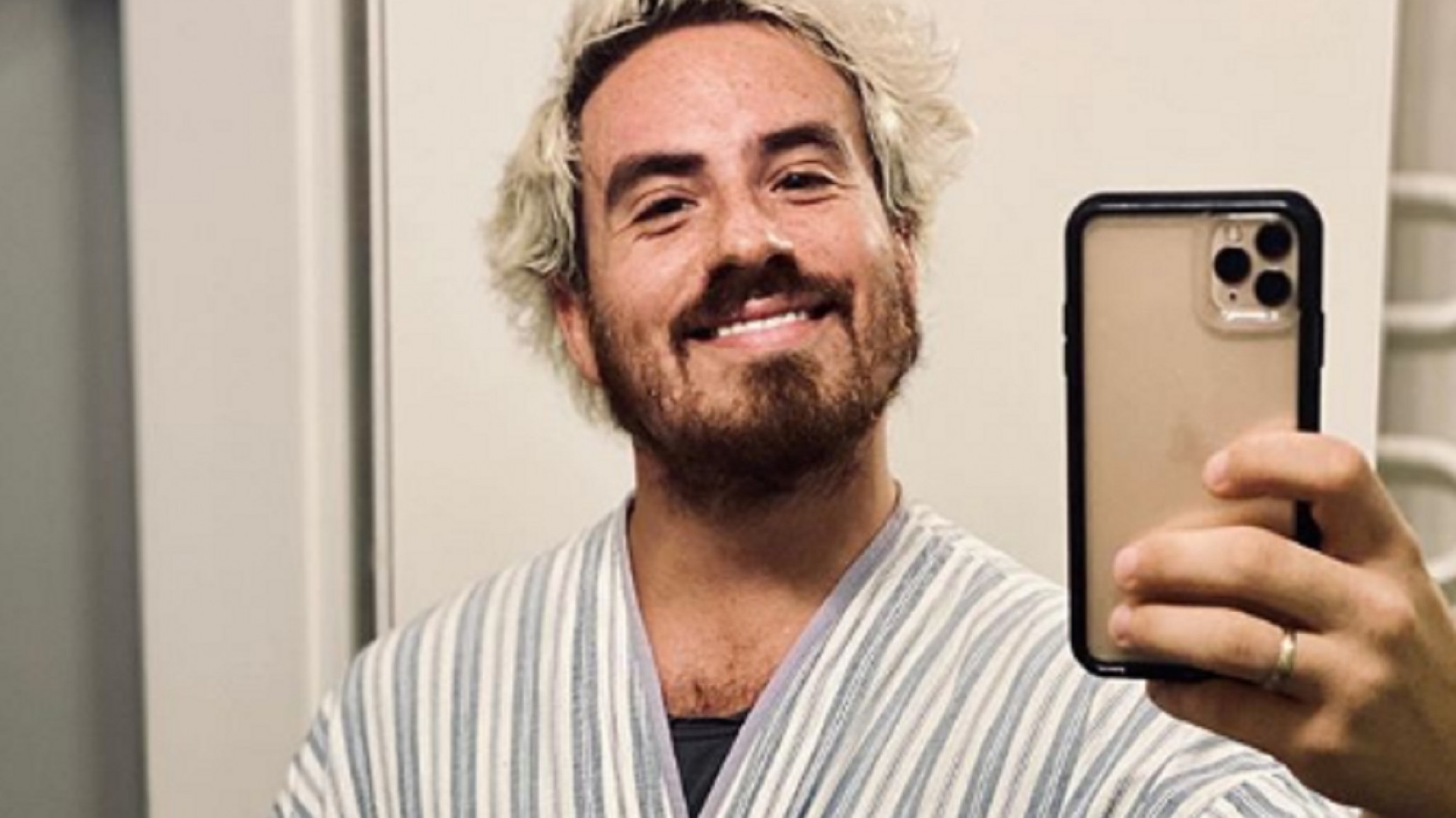 Fede Bal terminó con el tratamiento de quimioterapia: “La primera etapa fue difícil”