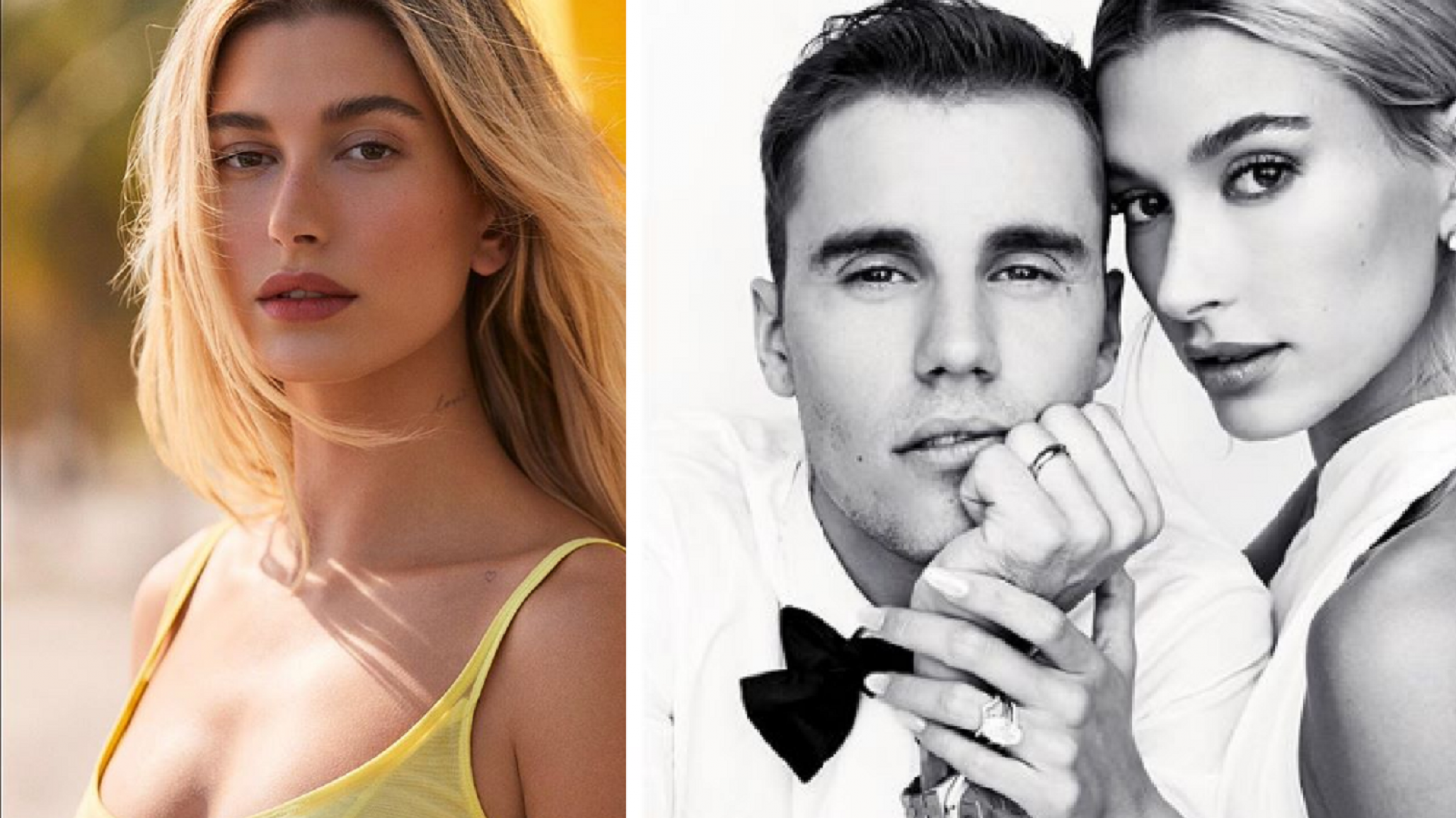 Hailey Bieber furiosa contra las versiones de una cirugía plástica