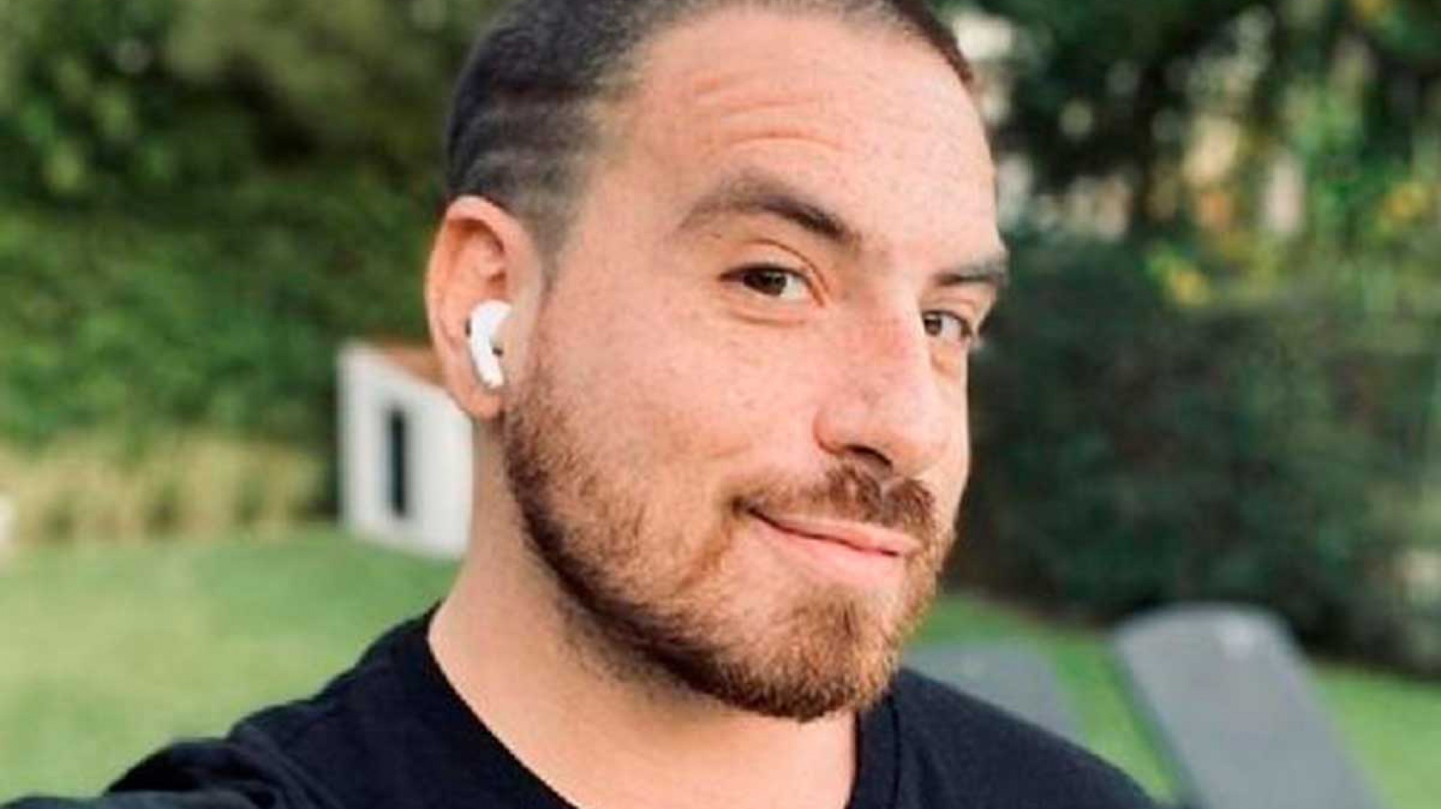 Fede Bal terminó la quimioterapia y reveló cómo seguirá su tratamiento