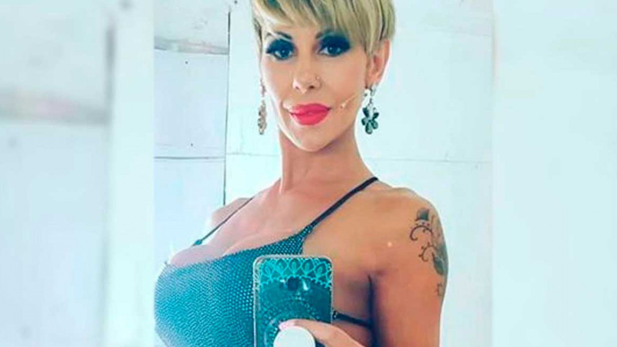 Mónica Farro salió del quirófano y no podrá caminar por un mes