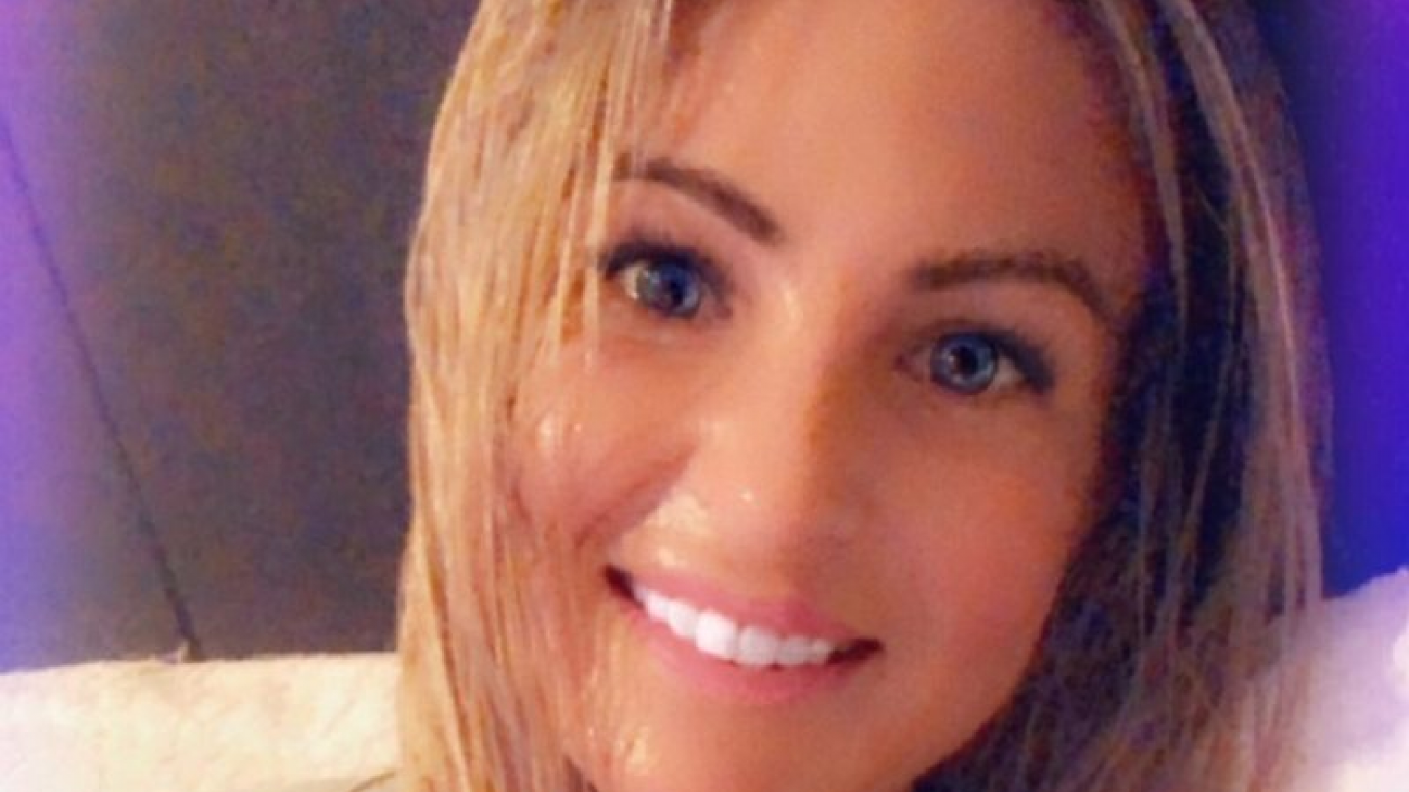 Sufrió quemaduras graves por prender una vela después de usar desinfectante de manos