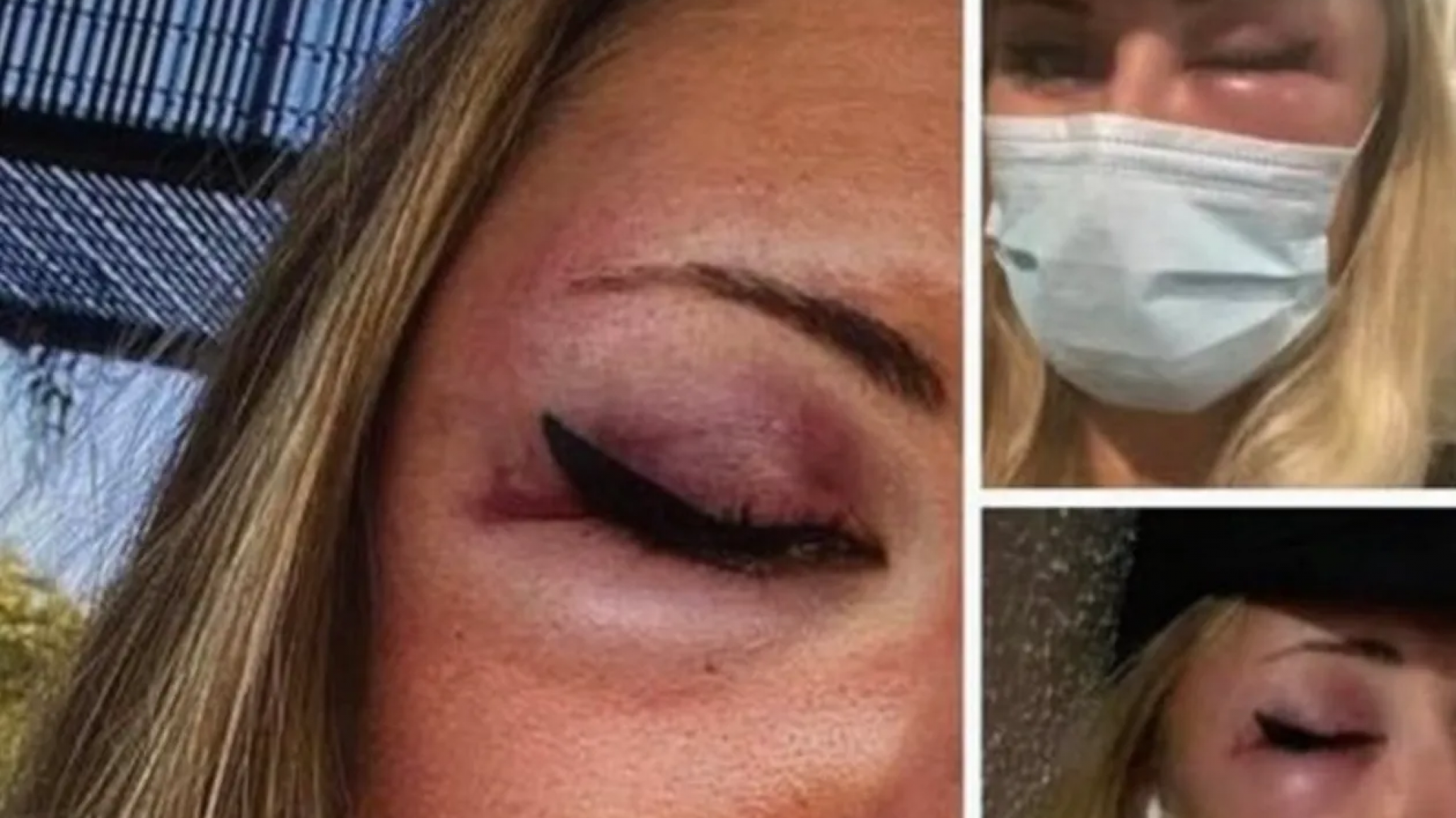 Mujer fue golpeada e insultada por llevar falda