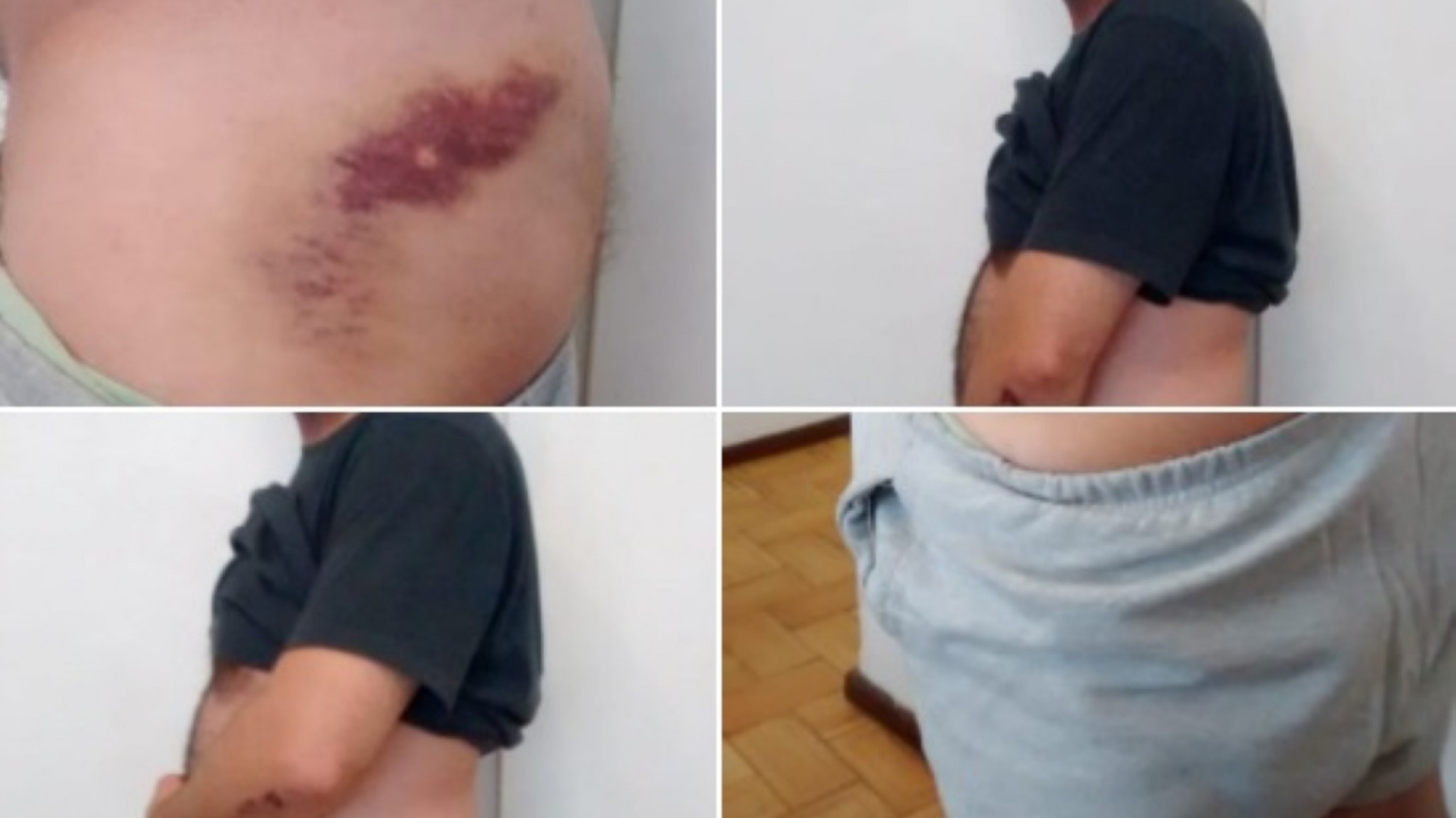 Atacaron a perito gendarme que denunció irregularidades en la causa Nisman y quisieron matar a su abogado