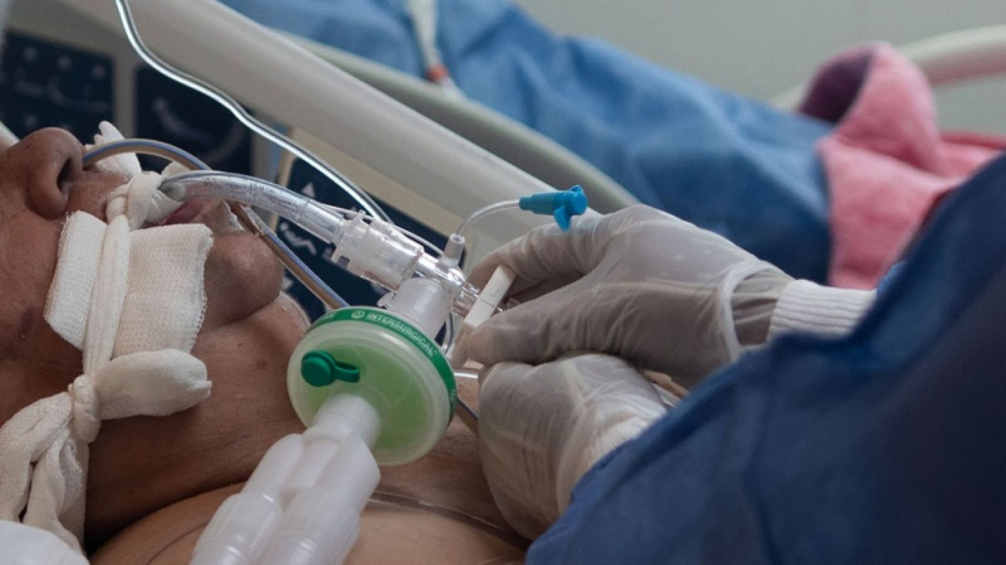 Médico de SAE advirtió “No parece para nada lejano el momento de elegir a qué paciente atender con un respirador”