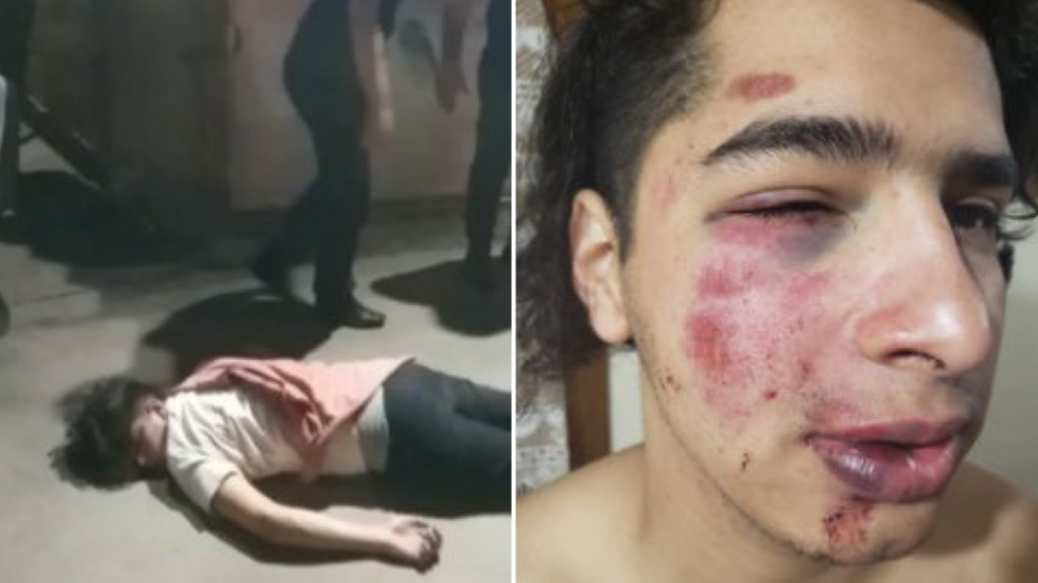 Joven fue golpeado a la salida de boliche “me agarraron 5 patovas y me re cagaron a piñas”
