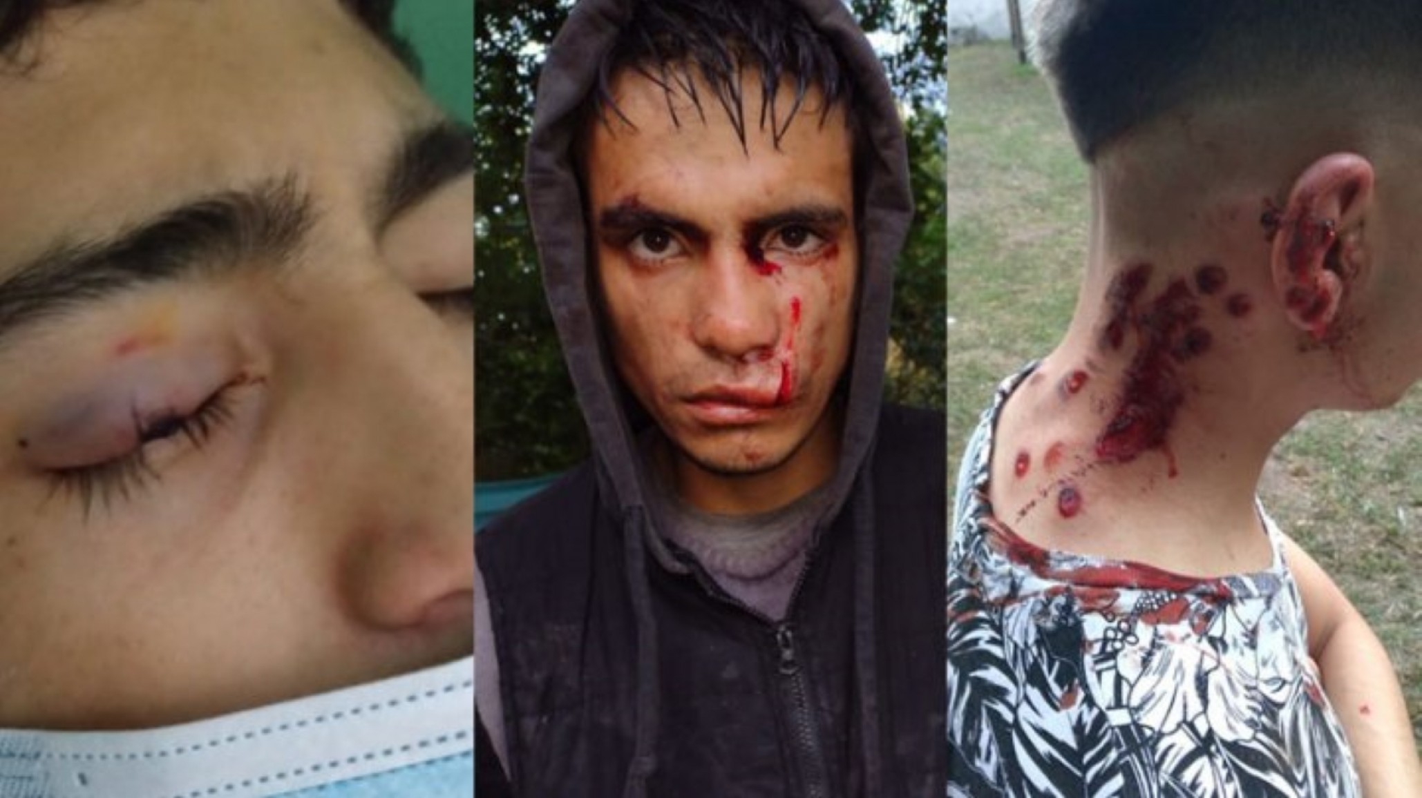 Madre denuncia que la policía hirió a 11 jóvenes con balas de goma ?todo dentro de mi casa?