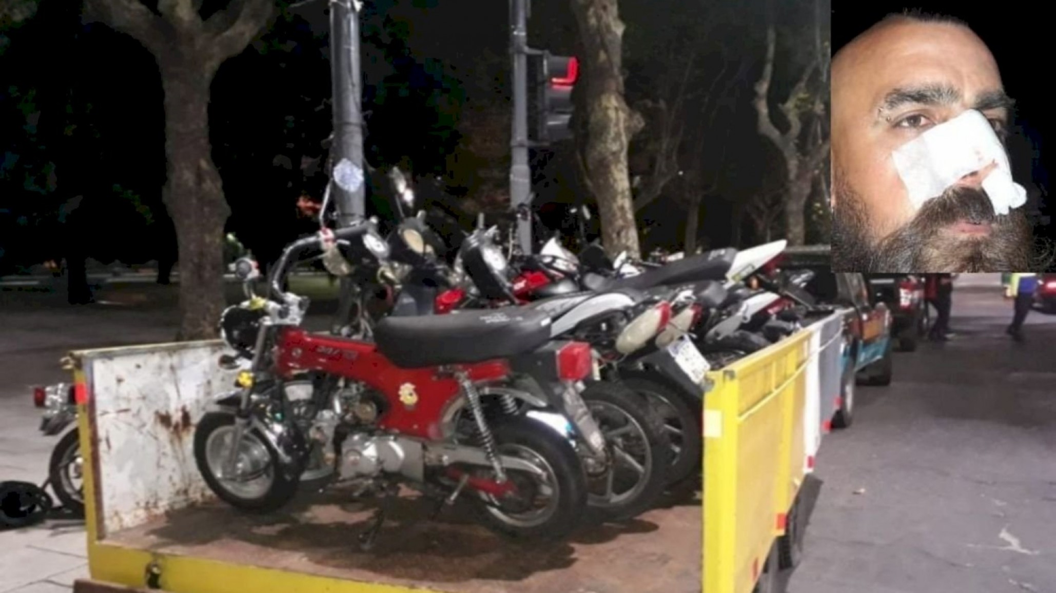 En un control vehicular un conductor le pegó un codazo a agente y le fracturó el tabique