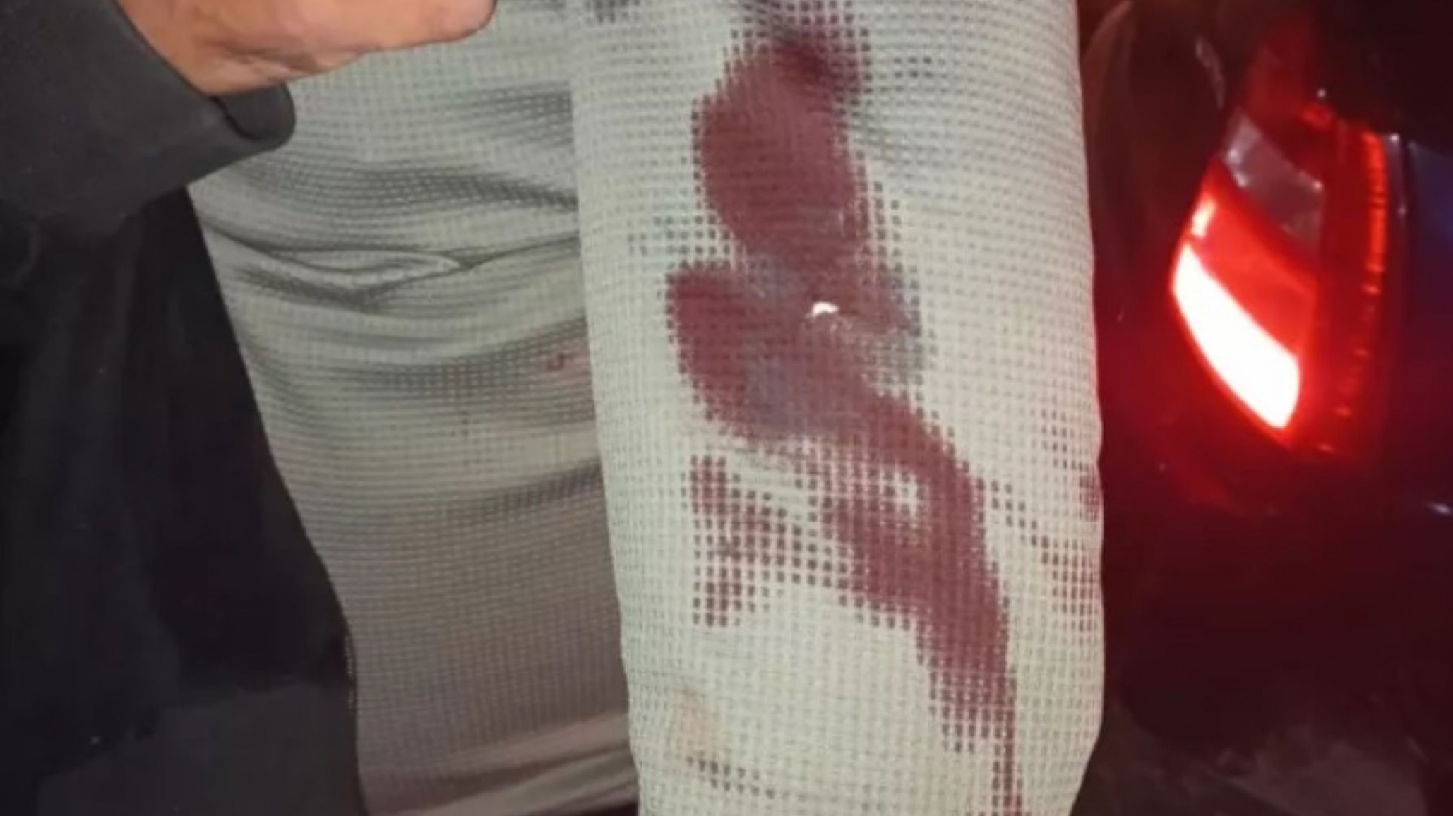 Un hombre fue apuñalado en medio de una pelea