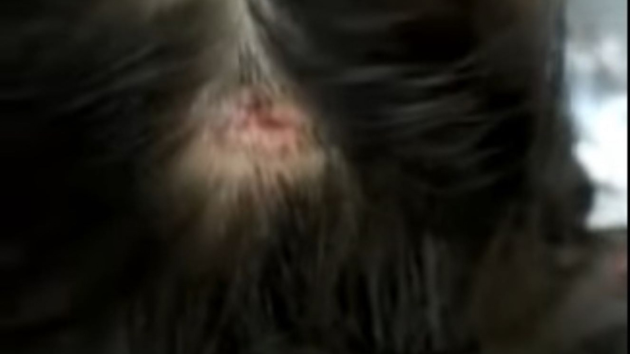 Madre denuncia abandono de persona: su hija se cayó en la escuela y no fue asistida