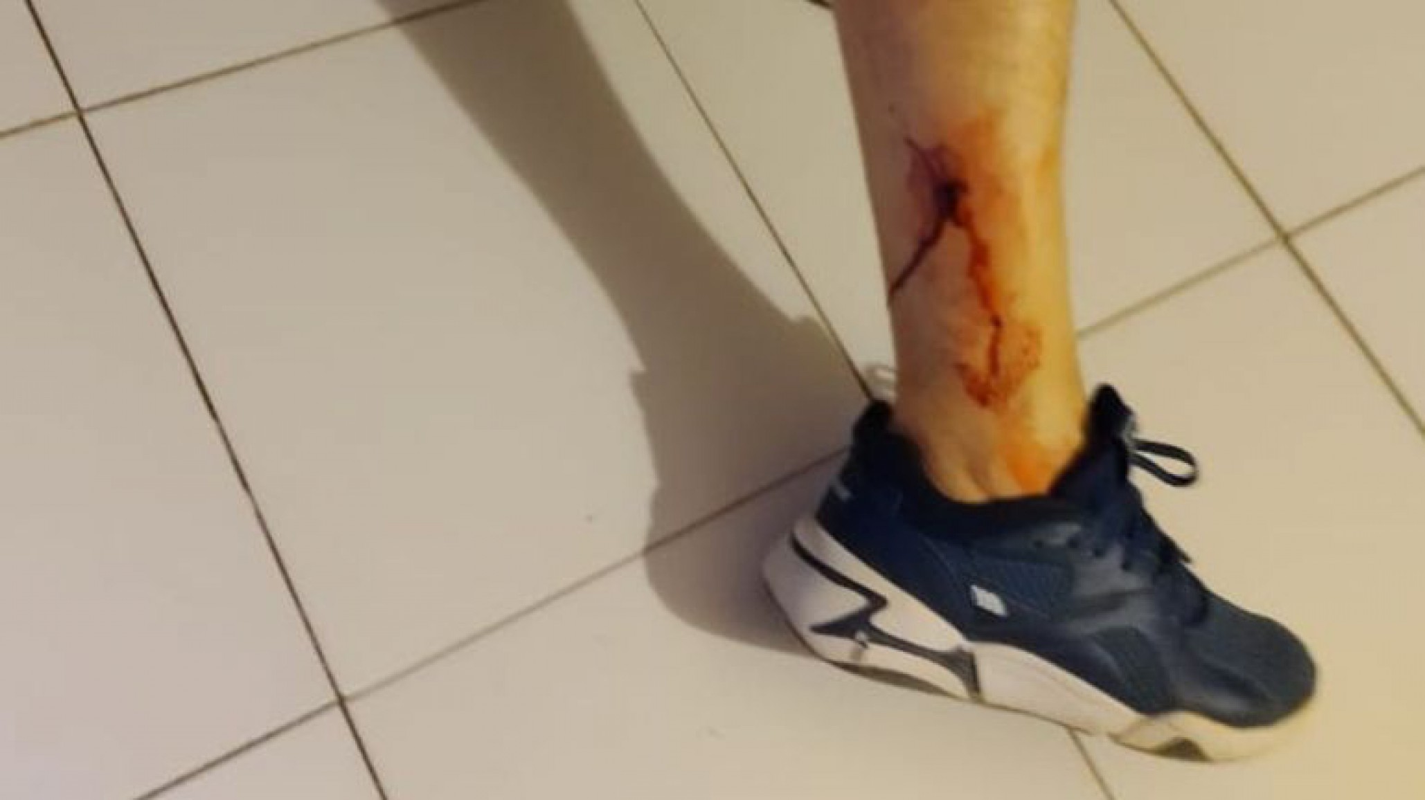 Un hombre quedó herido tras tiroteo en su vivienda