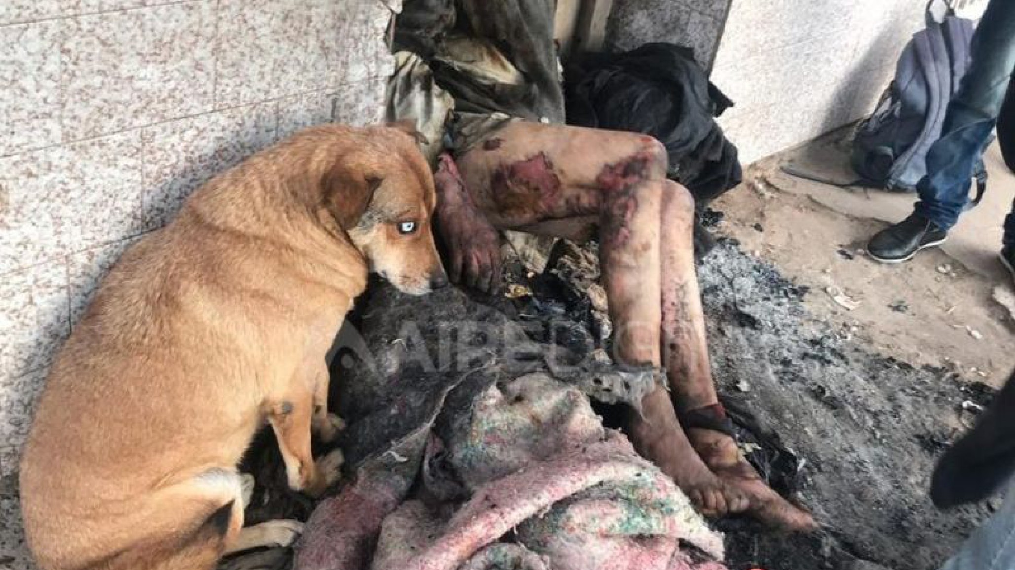 Prendieron fuego a un hombre que vive en la calle