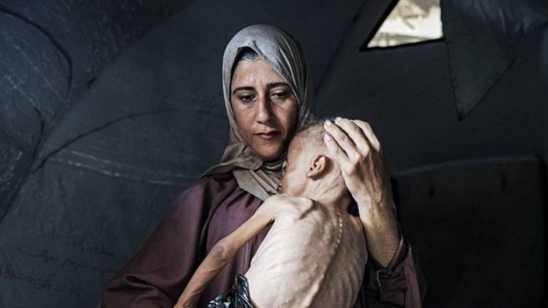 Más de 100 organizaciones denuncian hambruna masiva en Gaza