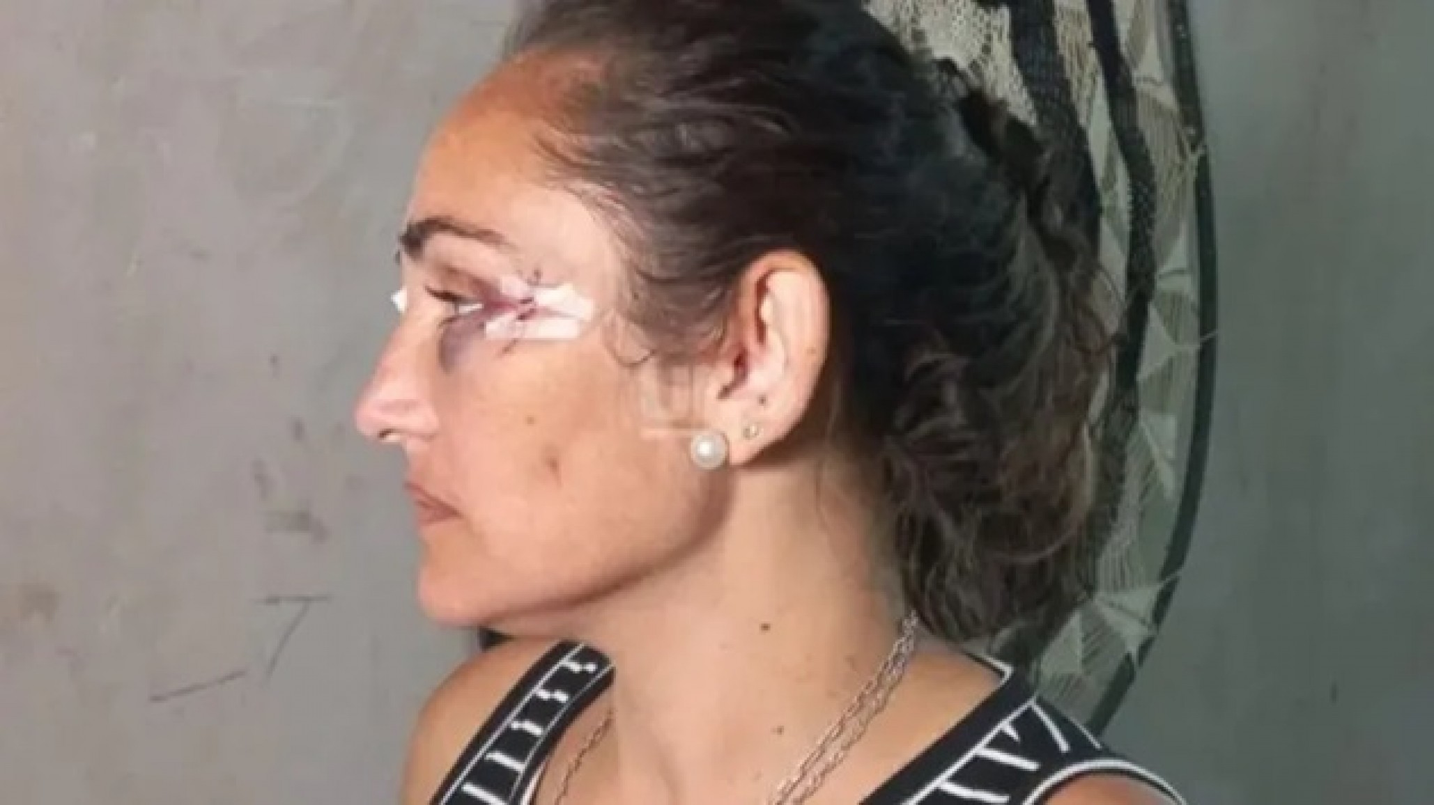 Dos mujeres detenidas por intentar matar a la hermana de un intendente de Santa Fe