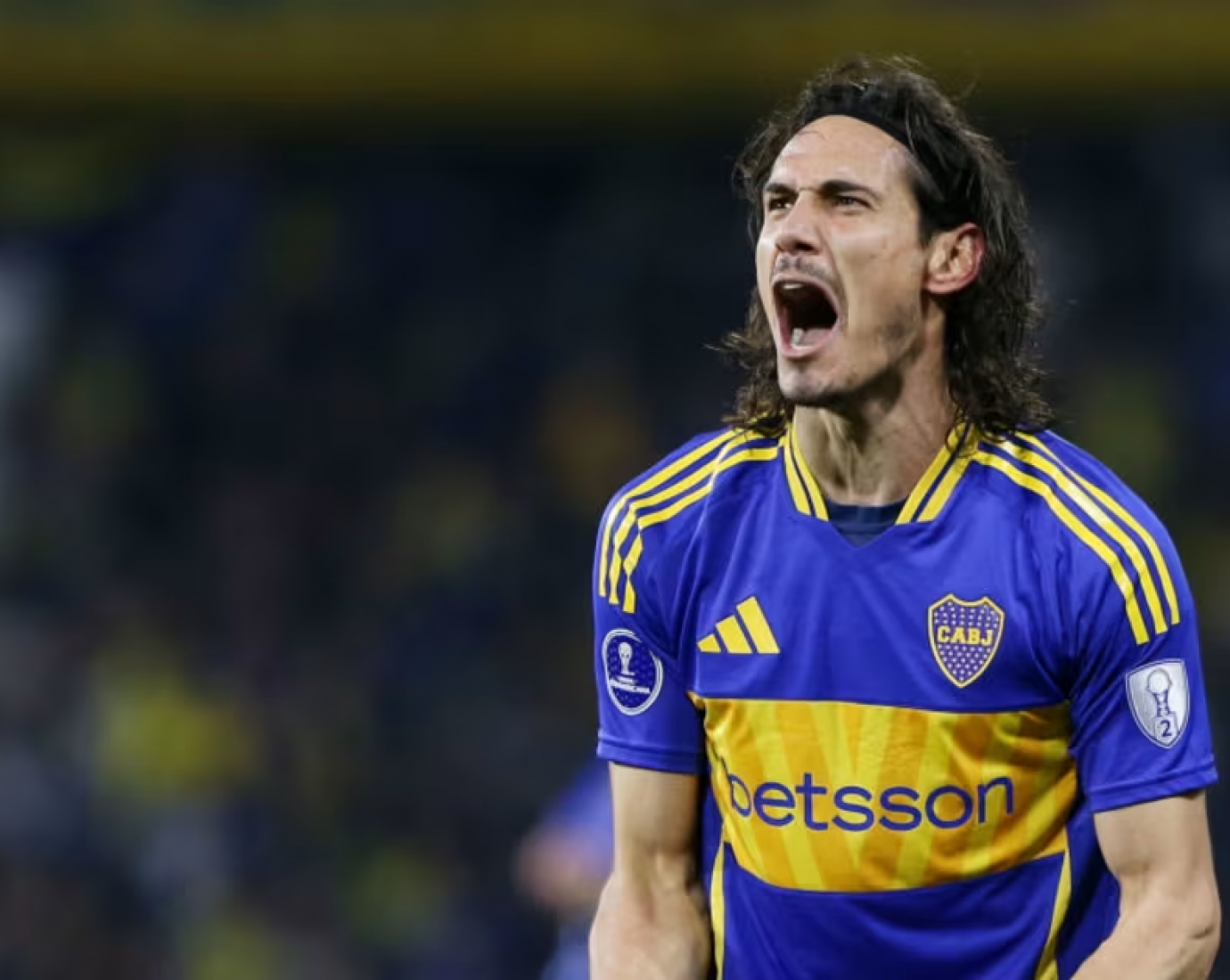 Golpe para Boca: Cavani se hará un tratamiento y será baja por un mes