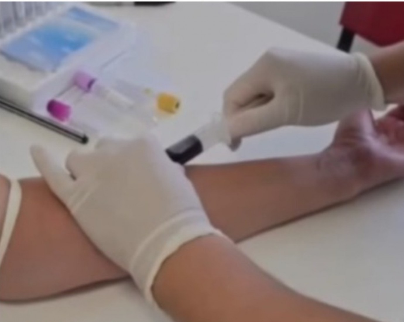 El Hospital Regional de Comodoro busca donantes de plaquetas para pacientes que lo necesitan