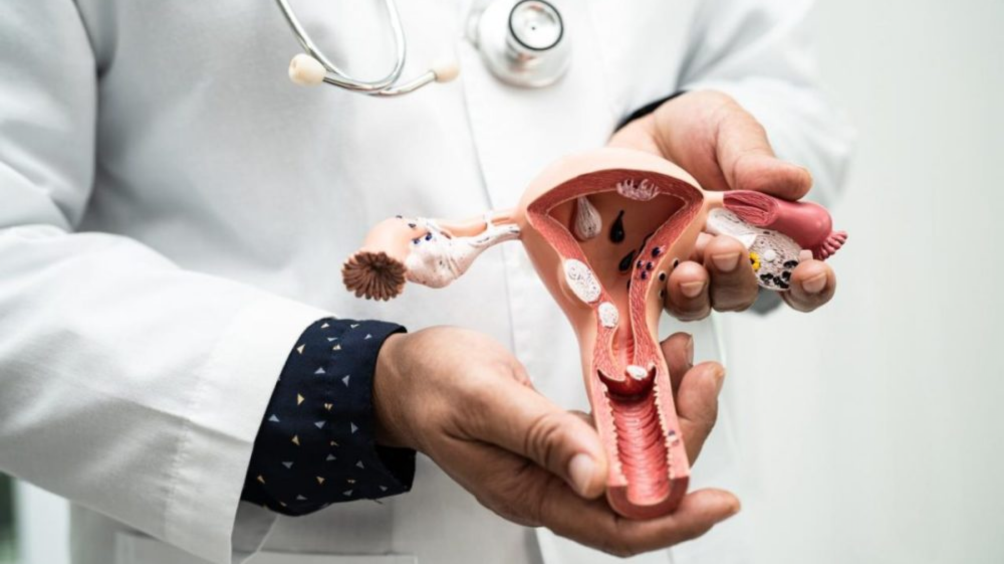 Lanzan una campaña gratuita para la detección del cáncer de cuello uterino