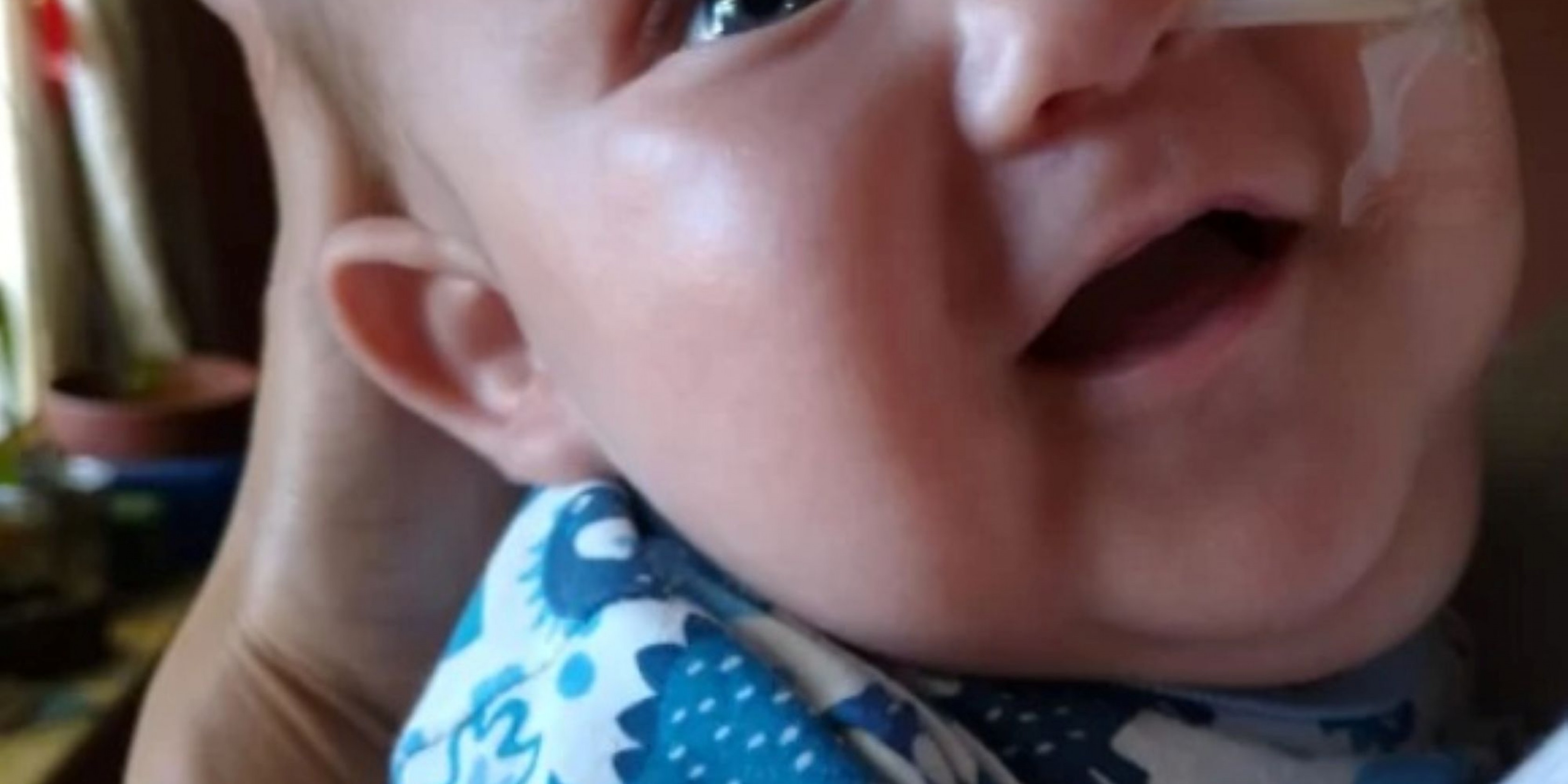 Dolor en Comodoro Rivadavia: murió un bebé con síndrome de Prune Belly tras permanecer internado