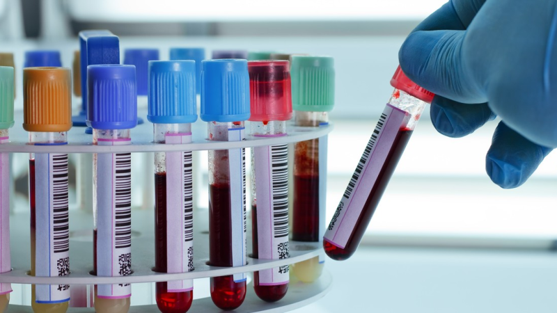 Bioquímicos de Chubut amenazan con cortar prestaciones a Seros