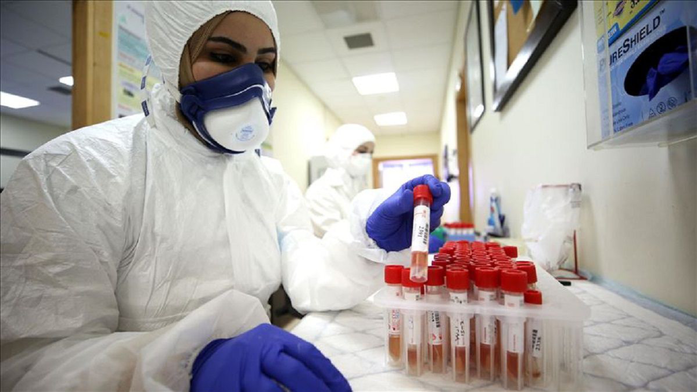 Tres antivirales contra el coronavirus probados con éxito