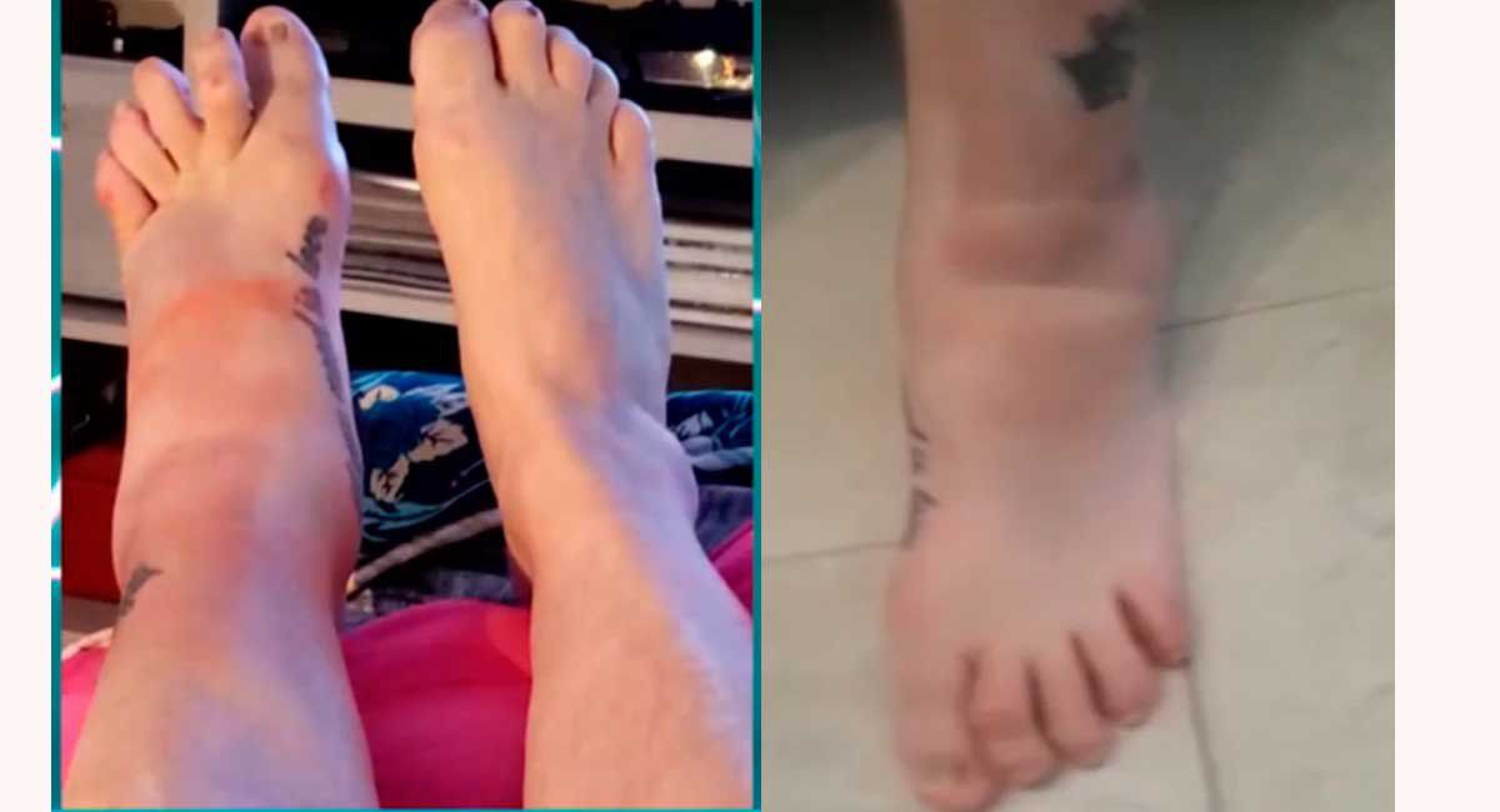 Carmen Barbieri mostró cómo quedaron sus pies tras la caída en el Cantando: ¡Qué dolor!